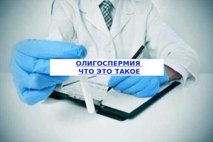 Фото: что такое олигоспермия у мужчин
